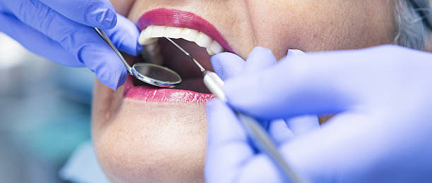 Best Emergency Treatment for Dental Infections or Abscesses in Trenton, FL